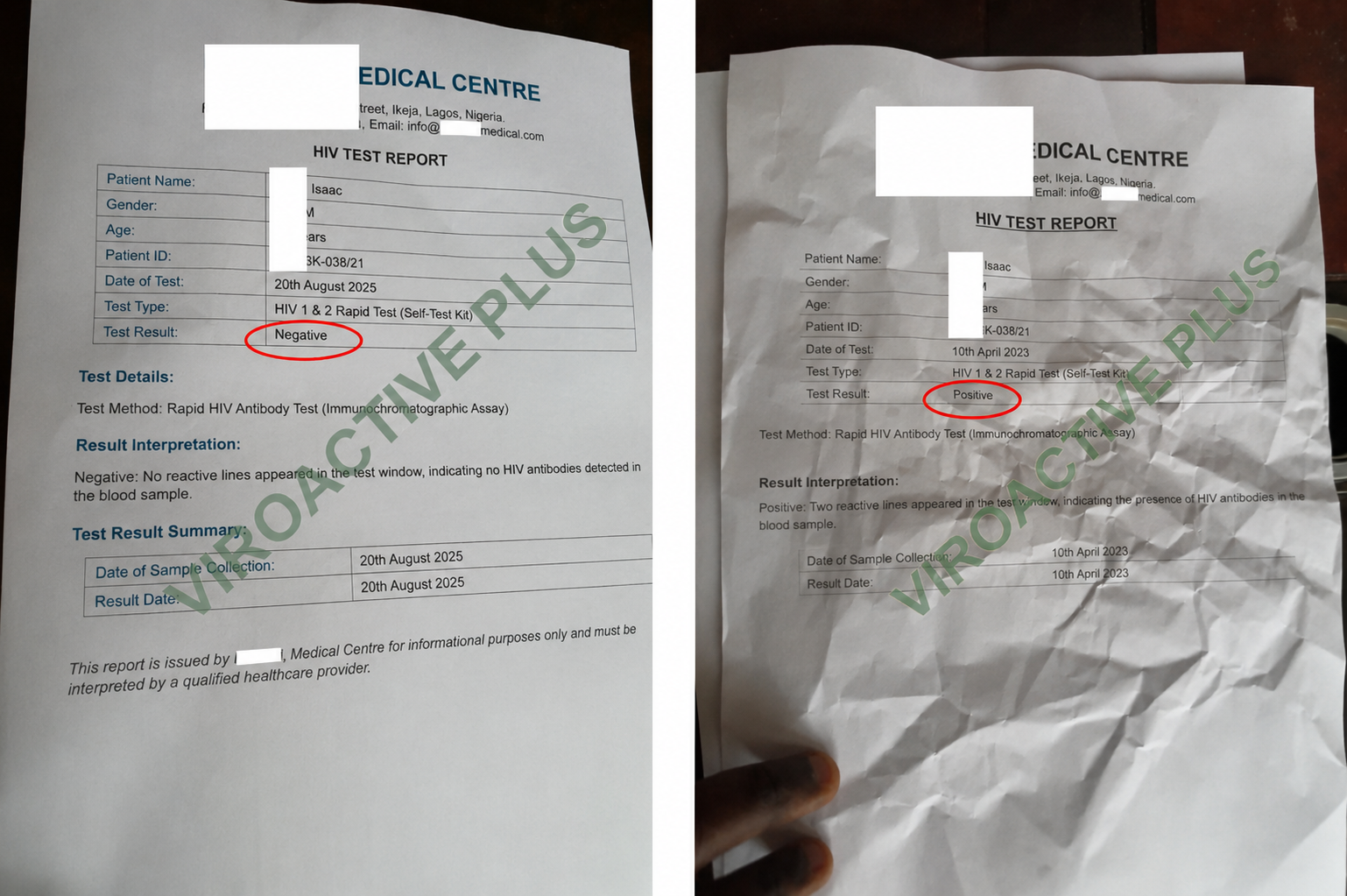 Mr. Isaac — Before & After Result